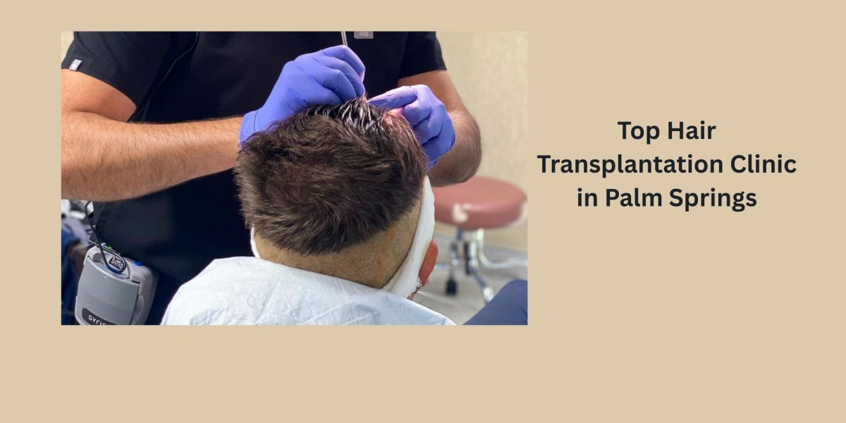 Top Hair Transplantation Clinic in Palm Springs
