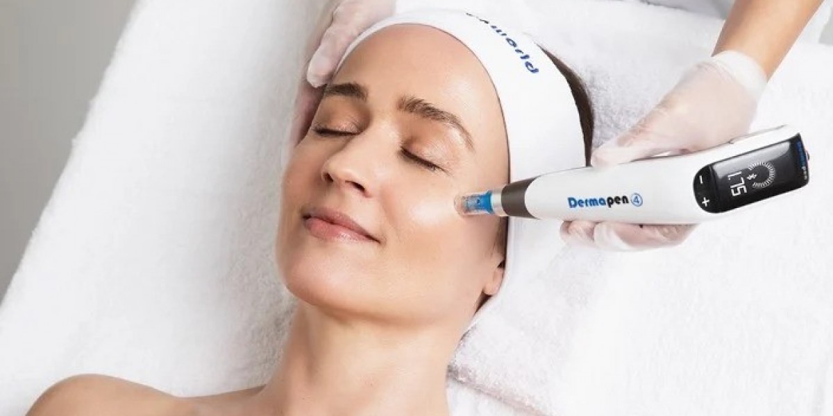 Restore Scarred Skin Using Microneedling Sessions